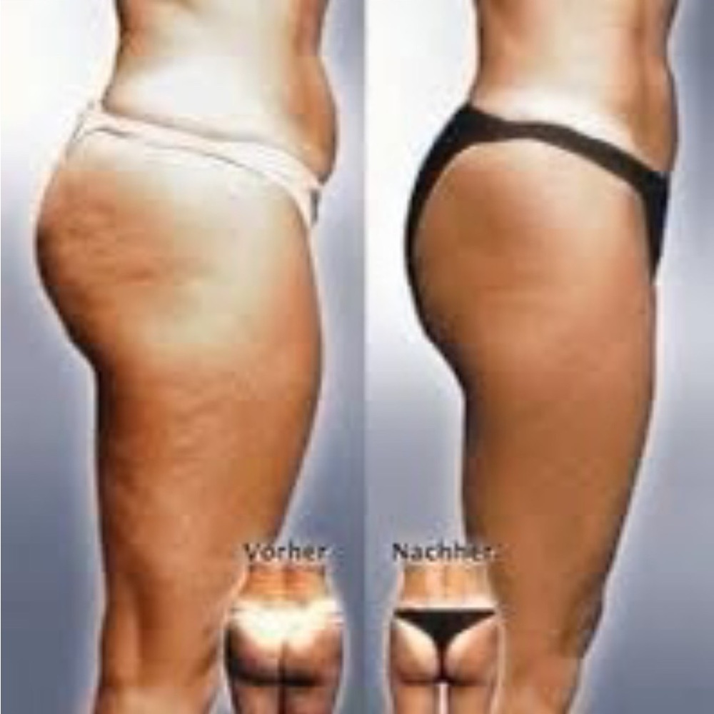 Nu Skin Dermatic Effects cellulite firming cream - Picture 9 of 16